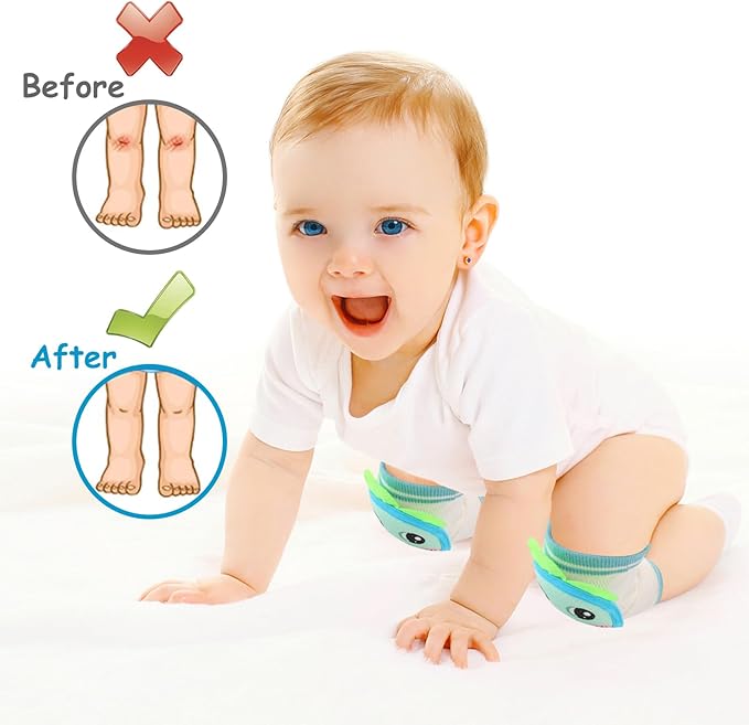NASHRIO Baby Knee Pads for Crawling, Anti-Slip and Protect Toddlers Knees. Knee Warmer and Breathable 3D Mesh for Boys and Girls, 3 6 12 Months Old Baby Must Haves (3 Pairs)